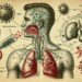 HIV und Mandelentzündung: Gibt es einen Zusammenhang?